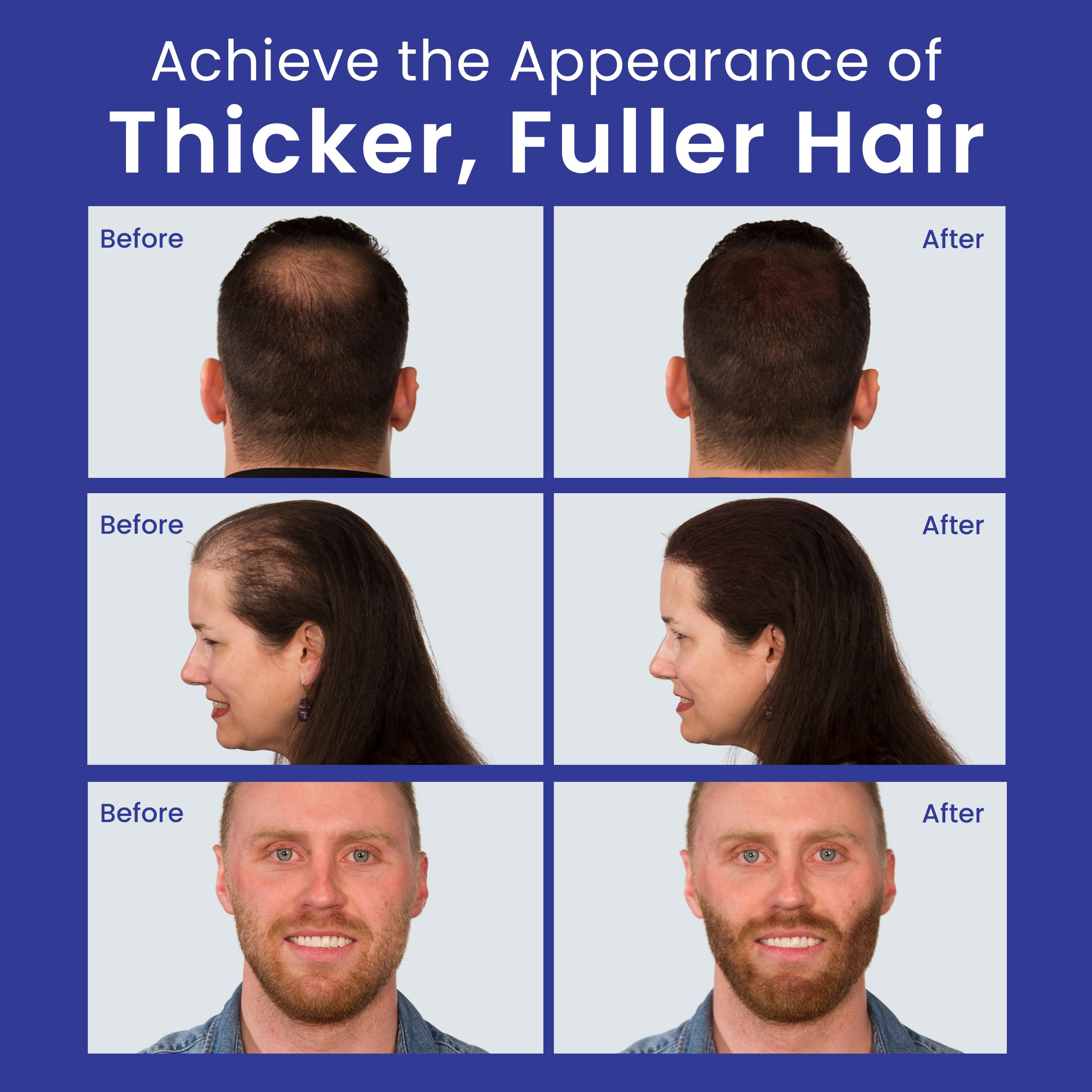 INFINITY Hair Fibers Dark Brown for Thinning Hair for Women & Men - 100% Undetectable Hair Building Fiber Powder - Conceal Hair Loss in 15 Seconds, 60g