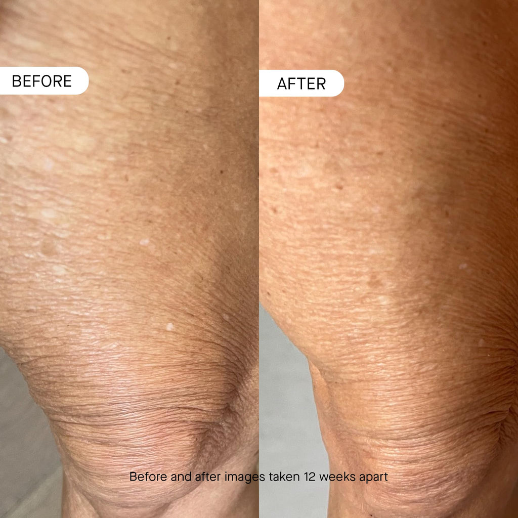 OneSkin BODY OS-01 Peptide Topical Supplement & Skin Longevity Age Reversal Moisturizer | Safe for Sensitive Skin, Fragrance-Free, 250 mL / 8.45 oz