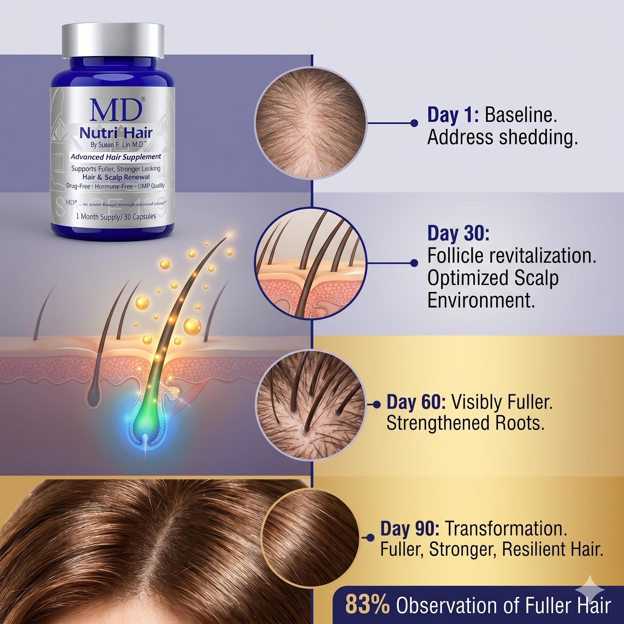 MD Nutri Hair Growth Supplement for Thinning and Hair Loss, Reduces Shedding, Lilac Stem Cells with Marine Collagen and Biotin, 30 Vegetable Capsules