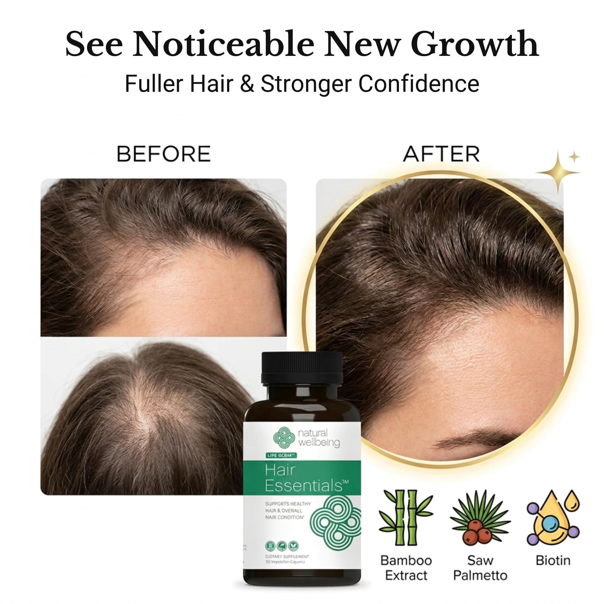 Natural Wellbeing Hair Essentials – DHT Blocker Hair Growth Supplement for Women & Men – Saw Palmetto, Biotin, – Vegan Capsules – Stops Shedding & Thinning (90 Count, 1-Month Supply)