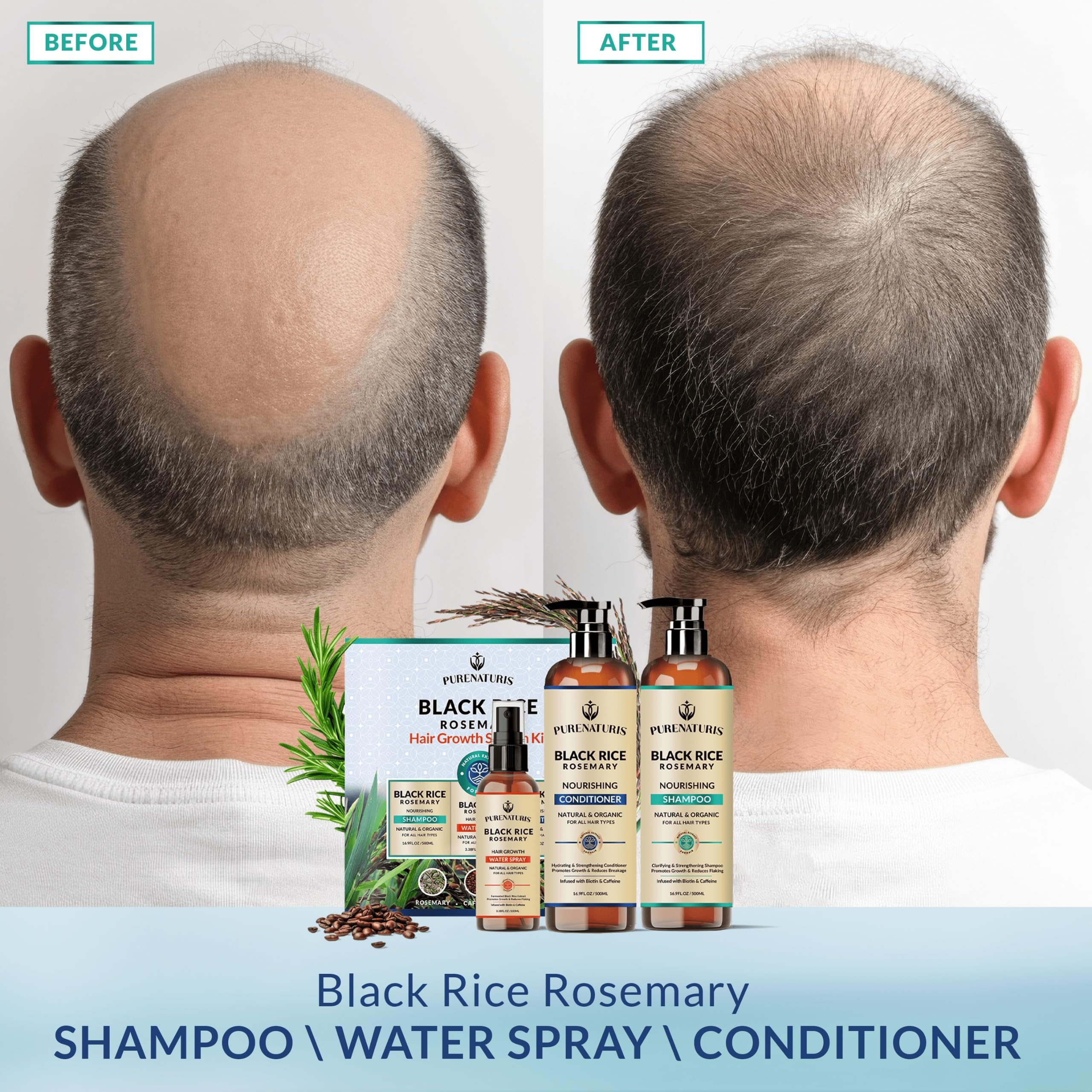 PureNaturis Organic Rosemary Black Rice Water Shampoo Conditioner Set for Hair Growth, Rice Water Spray, w/Rosemary Water, Biotin, Caffeine, Routine Shampoo for Women Men Hair Loss Thickening, Longer